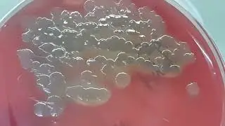 Pseudomonas aeruginosa growth on Blood agar