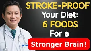 Stroke Proof Your Diet, Eat These 6 Brain Friendly Foods