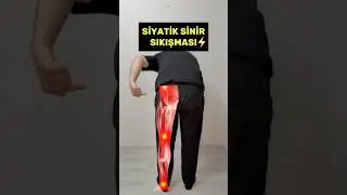 Siyatik Sinir Sıkışması / Egzersiz / #egzersiz #siyatik #fizyoterapi