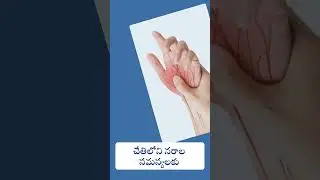 Your Hand Health Matters: Consult Dr. Bindesh Today || Dr. Bindesh Hand & Microsurgery ||