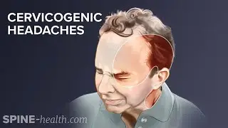 Cervicogenic Headache