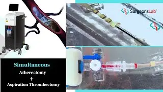 Cutting-Edge Atherectomy Simulation: See the Future of Vascular Training in Action! | SurgeonsLab AG