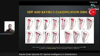 classification of root canal system تصنيف أنواع قنوات عصب السن