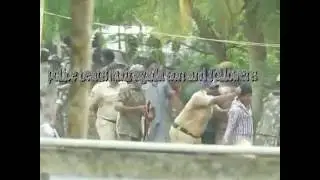 police beats mudragada's son