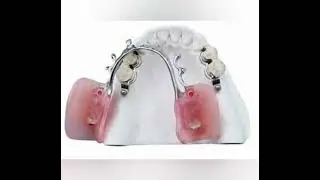 CO CR MK1 Precision Attachment Denture Corrosion Resistance
