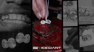16-carat double fangs  Grillz & two larger full diamonds