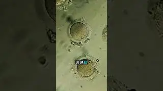&Oacute;vulo Bajo El Microscopio 🔬