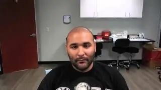 Best Hair Transplants by Matthew Huebner, Hair Transplant Surgeon