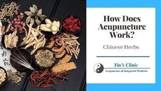 How Does Acupuncture Work? Chinese Herbs &ndash; Yin&rsquo;s Acupuncture & Herbs Clinic | (972) 668-2626
