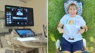 10 Weeks Pregnant!! (Live Scan Footage) | Lesbian IVF Pregnancy - UK