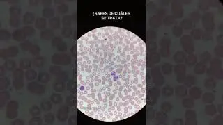 Linfocito y neutr&oacute;filos segmentados #hematologia #labclinico #leucocitos