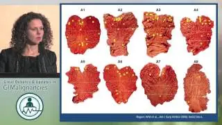 Update: Hereditary syndromes in GI cancer: Who should be tested and why?