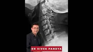 Cervical spine xray anatomy