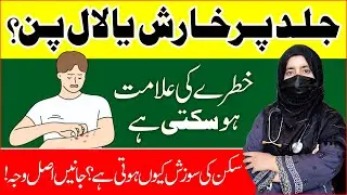 Skin Inflammation Treatment at Home | Kharish Ka ilaj | Skin Care Tips