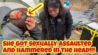 Homeless Woman's Harrowing Tale: Surviving a Hammer Attack in Canada #homeless #canada #woman #ad