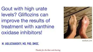 Gout with high urate levels? Gliflozins can improve a treatment with xanthine oxidase inhibitors!