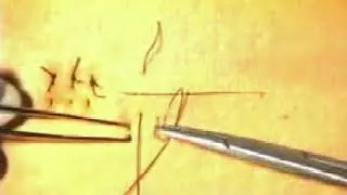 Mattress Suture - CPSP Pakistan