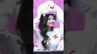 #blackpink before and after surgery #jenni # jisoo # lisa #Rose #yt #kpop #youtube short