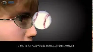 Eyewear Lens Shatter Resistance- Protection in Glasses for Use in Sports or by Children/Youth.