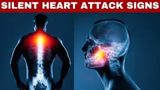Top Signs of Silent Heart Attack You Must Know! [2024 Update]