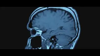 Park Avenue shooter targeting the NFL had CTE: Medical examiner