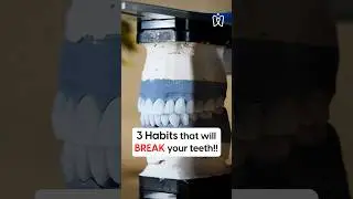 3 Everyday Habits That Harm Your Teeth #shorts #dentalhealth  #badhabits