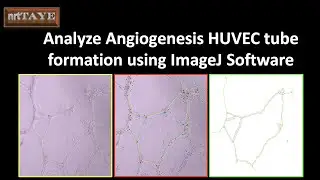 How to analyze Angiogenesis HUVEC cell tube formation assay using ImageJ Software