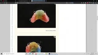 Scientific Evidence / Studies for Mewing / Myofunctional Therapy / Body Correction (Video #2)