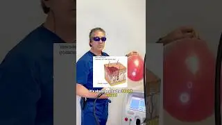 Laser vs Redness --What ACTUALLY Happens in Real Time! #lasertreatment #rosacea
