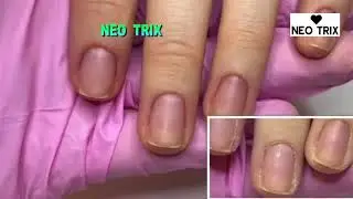 NASTY Nails Cleaning Trimming Transformation Manicure Tutorial 💍