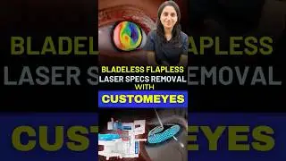 AI-Based Flapless Laser Surgery With CustomEyes | Safe & Painless Specs Removal