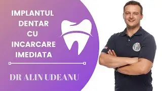 CE ESTE IMPLANTUL DENTAR CU INCARCARE IMEDIATA? | Dr. Alin Udeanu