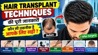 Type Of Hair Transplant | FUE vs FUT vs DHI | Best Technique For Hair Transplant