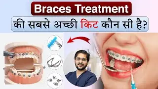 Braces में अच्छी Kit का महत्व 😬🦷 | कौन-सी Braces Kit चुनें? | Best Orthodontist in Indore