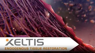 Our Success Stories: Xeltis &ndash; HeartRestore