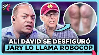 JARY RAM&Iacute;REZ Y RICHARD LLAMAN ROBOCOP A ALI DAVID POR DA&Ntilde;ARSE EL ROSTRO Y EL CUERPO CON OPERACIONES