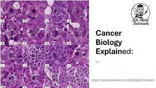 Cancer Biology Explained: How Cell Cycle Regulation Fails | AP & IB Biology