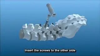 Spine user guide
