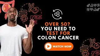 Do I need a Colonoscopy. I am over 50?