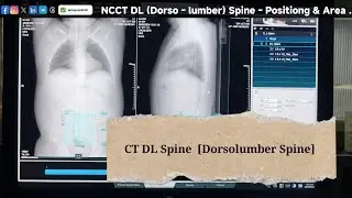 Ncct Dorso-lumber Spine  | By Anis Qureshi