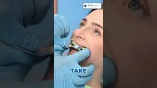 Full Mouth Restoration in San Jose del Cabo: Affordable Smile Makeover in Mexico!