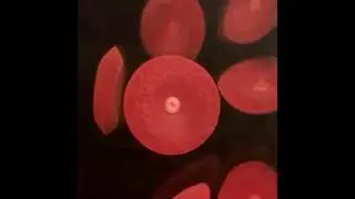 Red Blood Cells