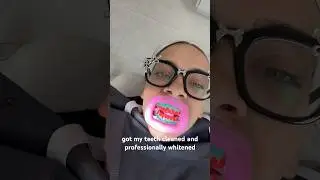 honest teeth whitening review experience on sensitive teeth