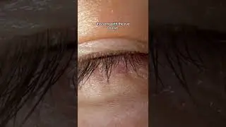 Eye Trend👀