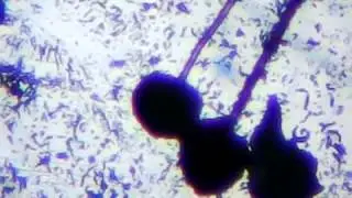 Fruiting body of Stachybotrys, mold black, views from the microscope.