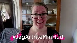 Rosacea -Jag &auml;r inte min hud - kreativaemma 2018