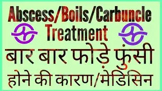 #Abscess#Boils#Carbuncle#बार-बार फोड़े फुंसी होने का कारण और इलाज#Carbuncle Treatment#Boils Remedy