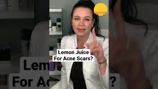 Lemon Juice For Acne Scars?  Is It Safe? #acne #acnetreatment #acnescars #acnescarshomeremedies