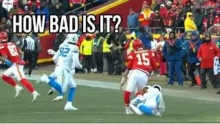 Mahomes Knee Injury Explained