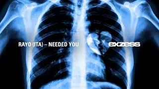 Rayo - Needed You [exzess]